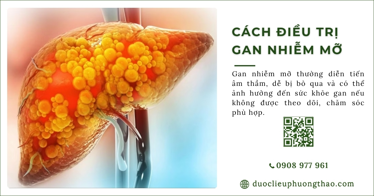 cách điều trị gan nhiễm mỡ