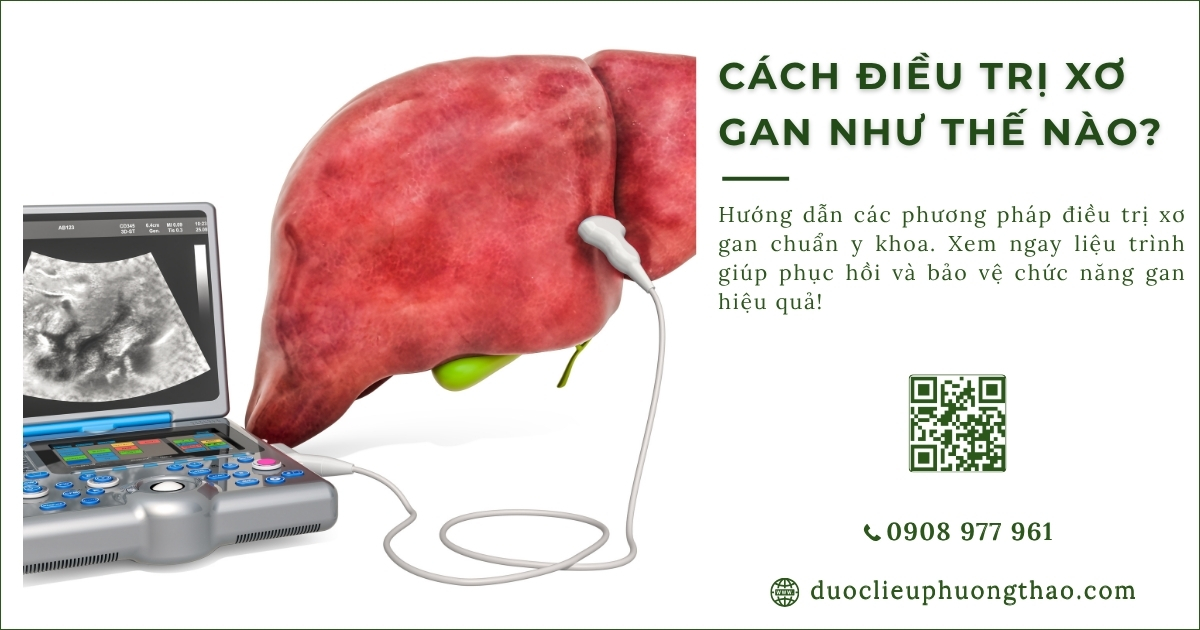 cách điều trị xơ gan