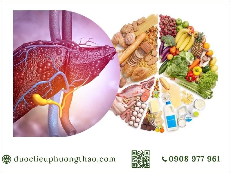 cách phòng tránh gan nhiễm mỡ