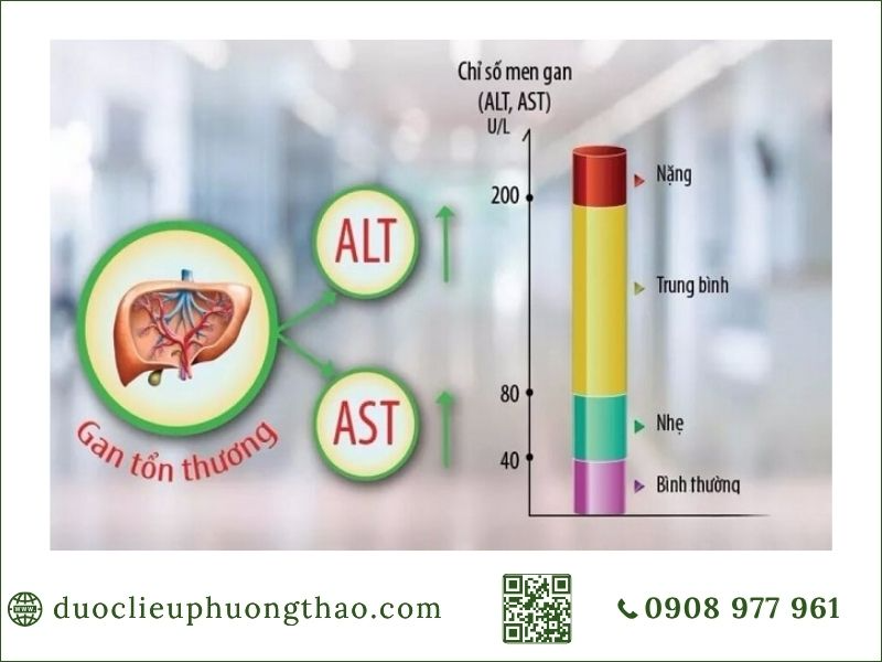 Men gan cao là gì? Nguyên nhân, triệu chứng và Cách phòng tránh như thế nào? chỉ số men gan cao