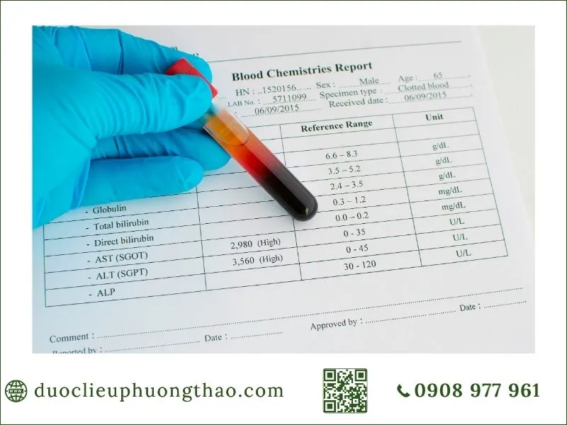 chỉ số men gan cao