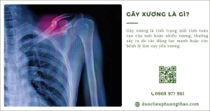 Gãy xương là gì? Nguyên nhân, dấu hiệu, cách xử lý ở người trung niên