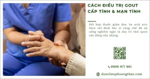 Cách điều trị gout cấp tính, cách xử trí và kiểm soát gout mãn tính