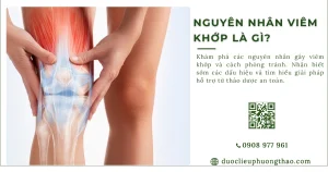 Nguyên nhân viêm khớp là gì? Các yếu tố nguy cơ cần biết?
