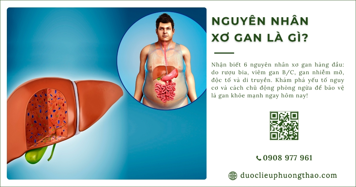 nguyên nhân xơ gan