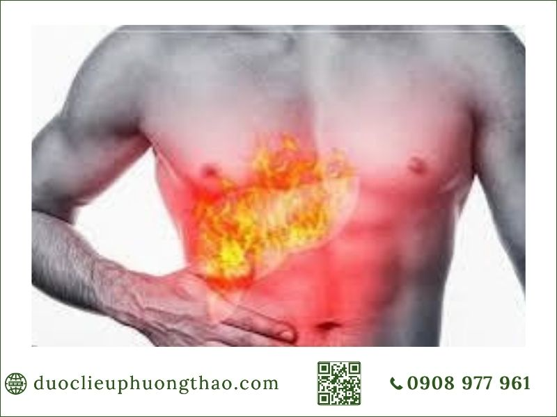 triệu chứng nóng gan