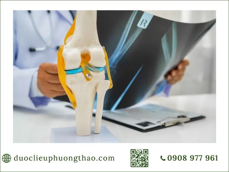 cách phòng tránh đau nhức xương khớp là gì