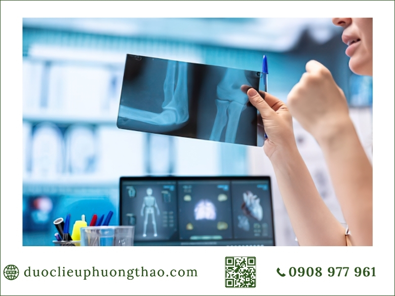 Cách điều trị đau nhức xương khớp: Phương pháp nào phù hợp và hiệu quả? Bác sĩ xem phim X-quang chẩn đoán đau nhức xương khớp