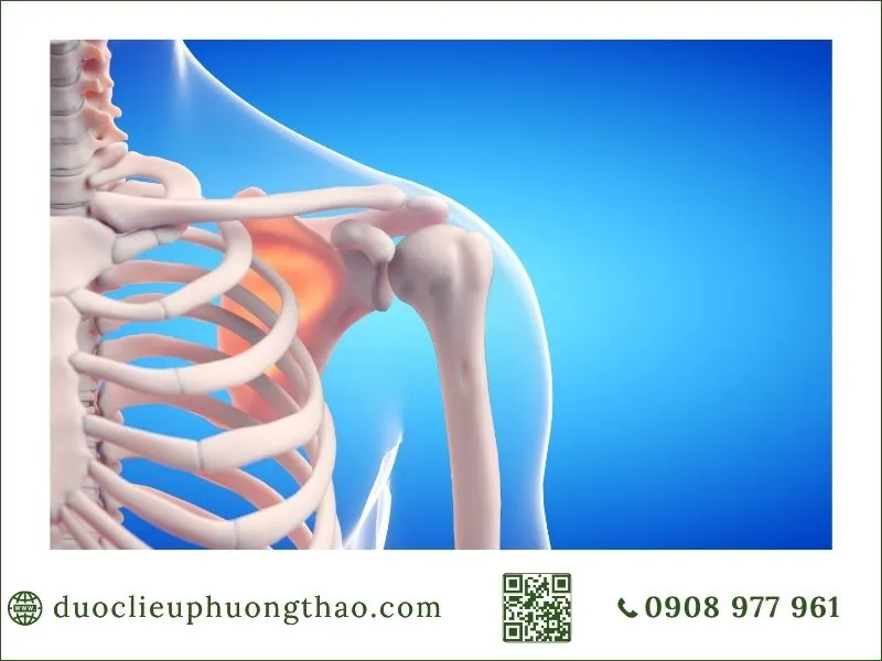 nguyên nhân đau nhức xương khớp là gì