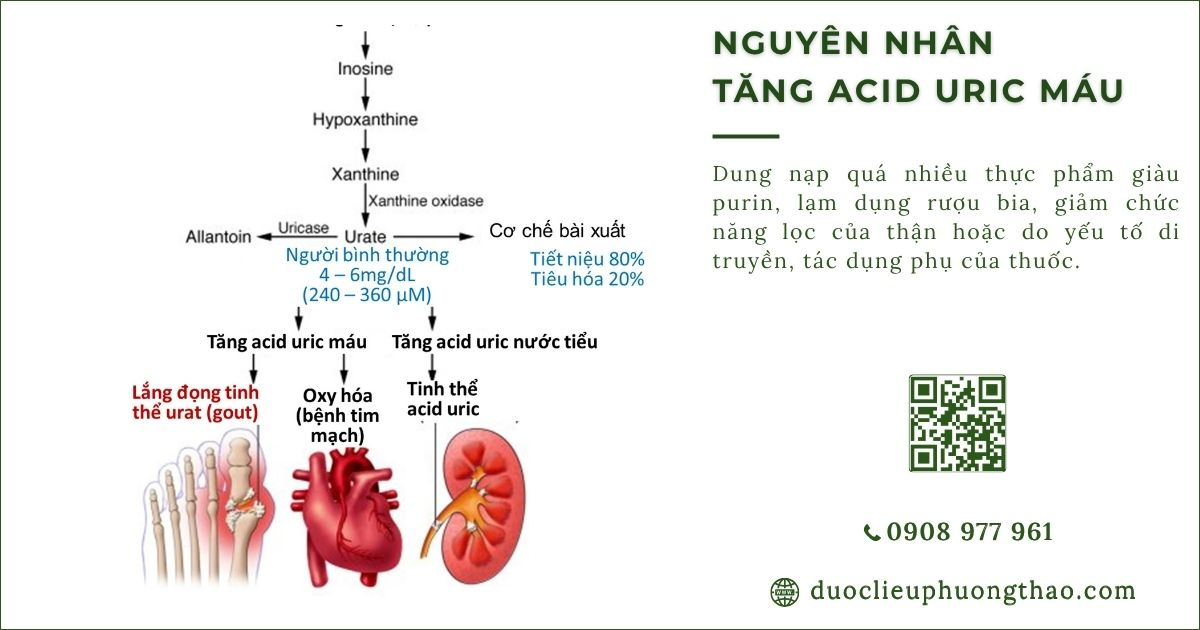nguyên nhân tăng axit uric máu