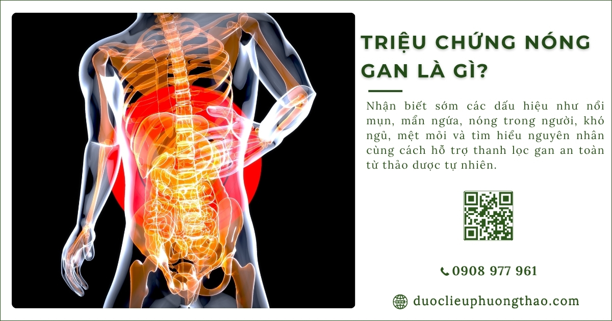 triệu chứng nóng gan