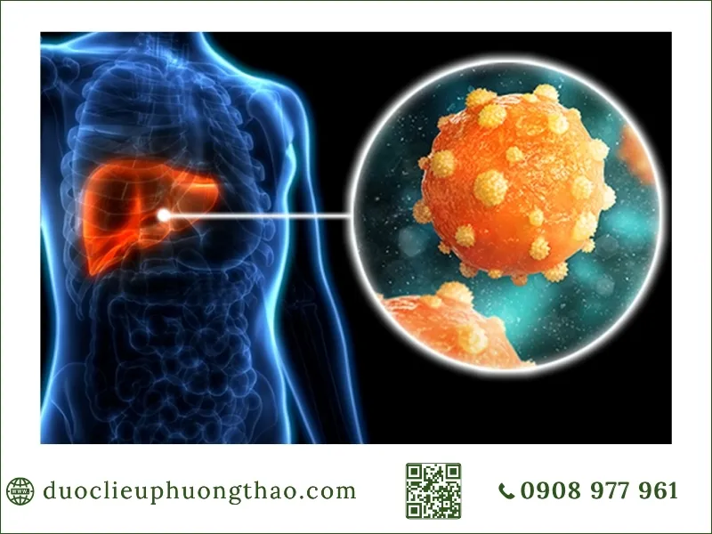 triệu chứng viêm gan B