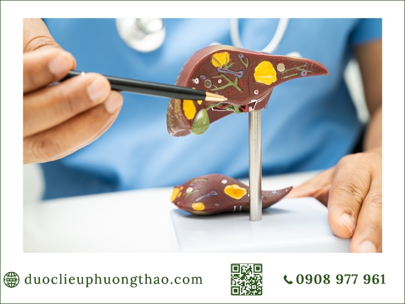 triệu chứng xơ gan