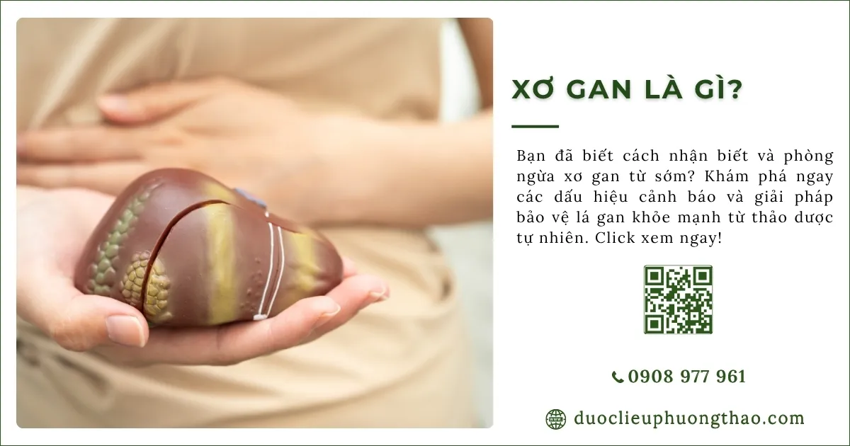 xơ gan là gì