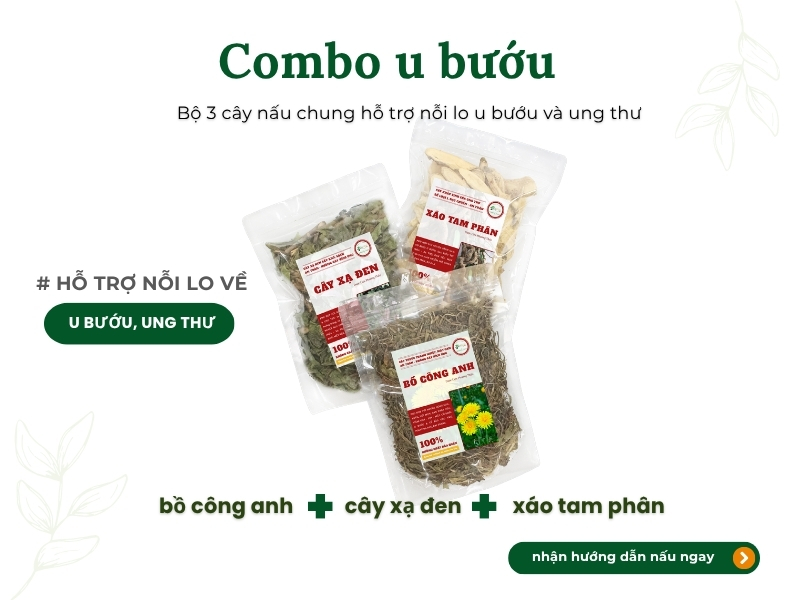 Bồ công anh (diếp dại, diếp trời) Combo u bướu gồm bồ công anh, xạ đen, xáo tam phân