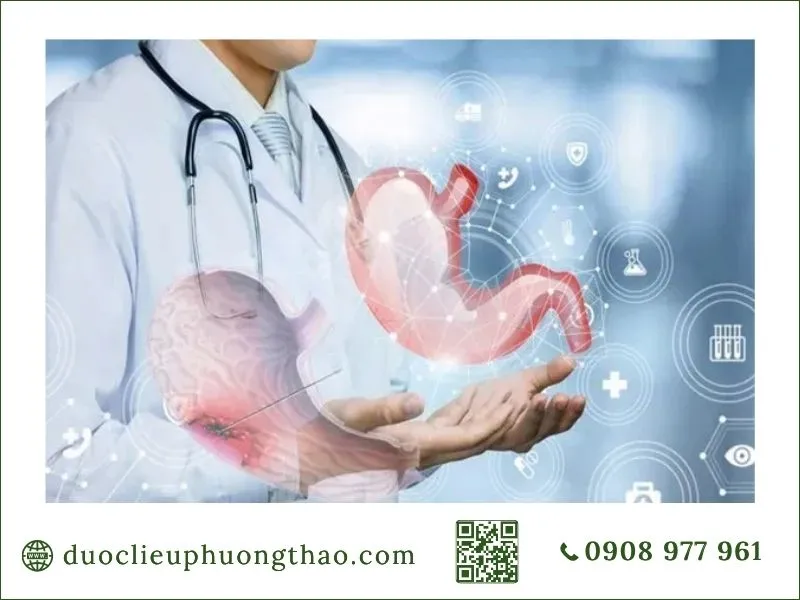 Bác sĩ chỉ vị trí khối u dạ dày trên mô hình giải phẫu
