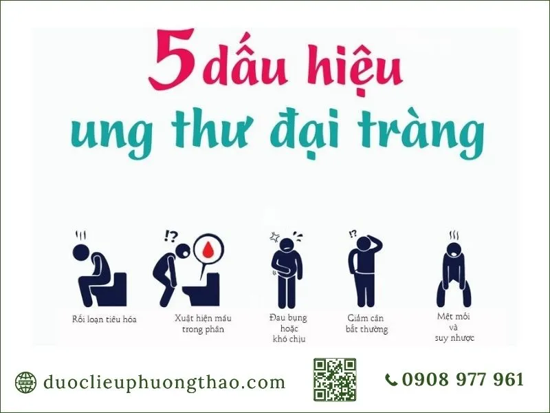 Ung thư đại tràng là gì? Nguyên nhân, triệu chứng và hướng xử lý cho người trung niên 5 dấu hiệu ung thư đại tràng cảnh báo người bệnh cần đi khám
