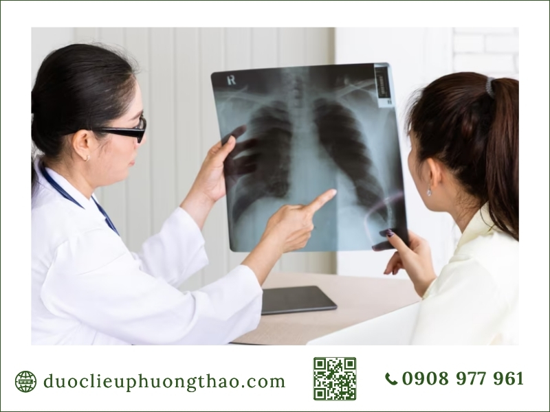 Bác sĩ giải thích phim chụp X quang phổi chẩn đoán nguyên nhân ung thư phổi là gì