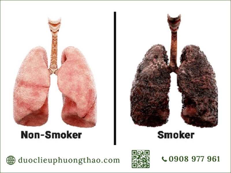 Sự khác biệt rõ rệt giữa lá phổi khỏe mạnh và phổi tổn thương do thuốc lá.