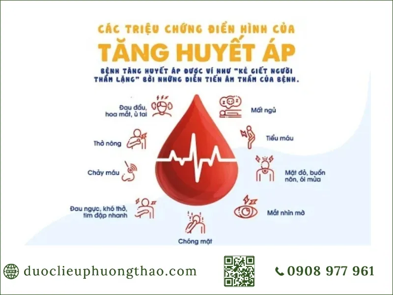 tổng hợp các triệu chứng điển hình của bệnh tăng huyết áp