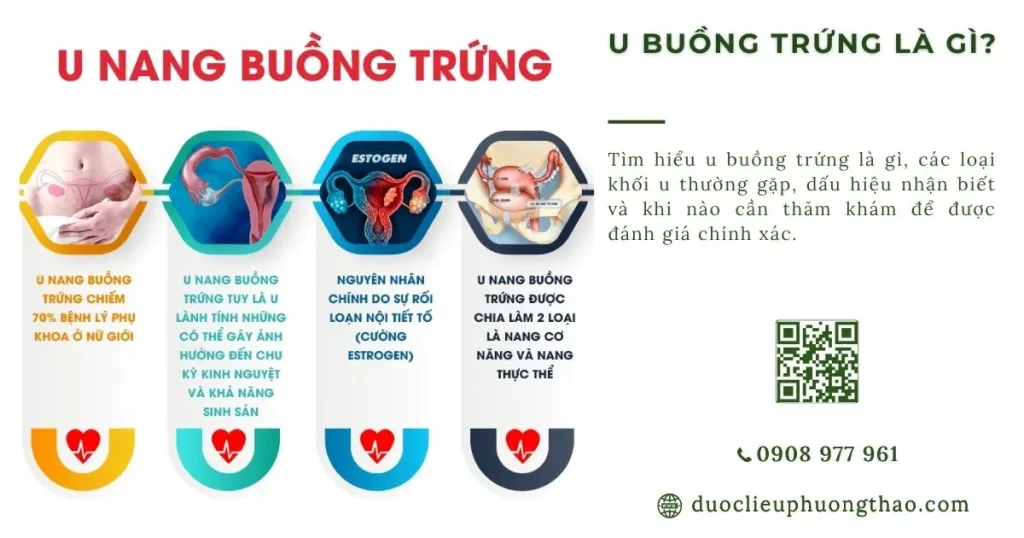 U buồng trứng là gì? Dấu hiệu, nguyên nhân và hướng xử trí phù hợp
