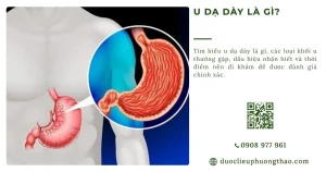 U dạ dày là gì? Nguyên nhân, triệu chứng và cách phòng tránh