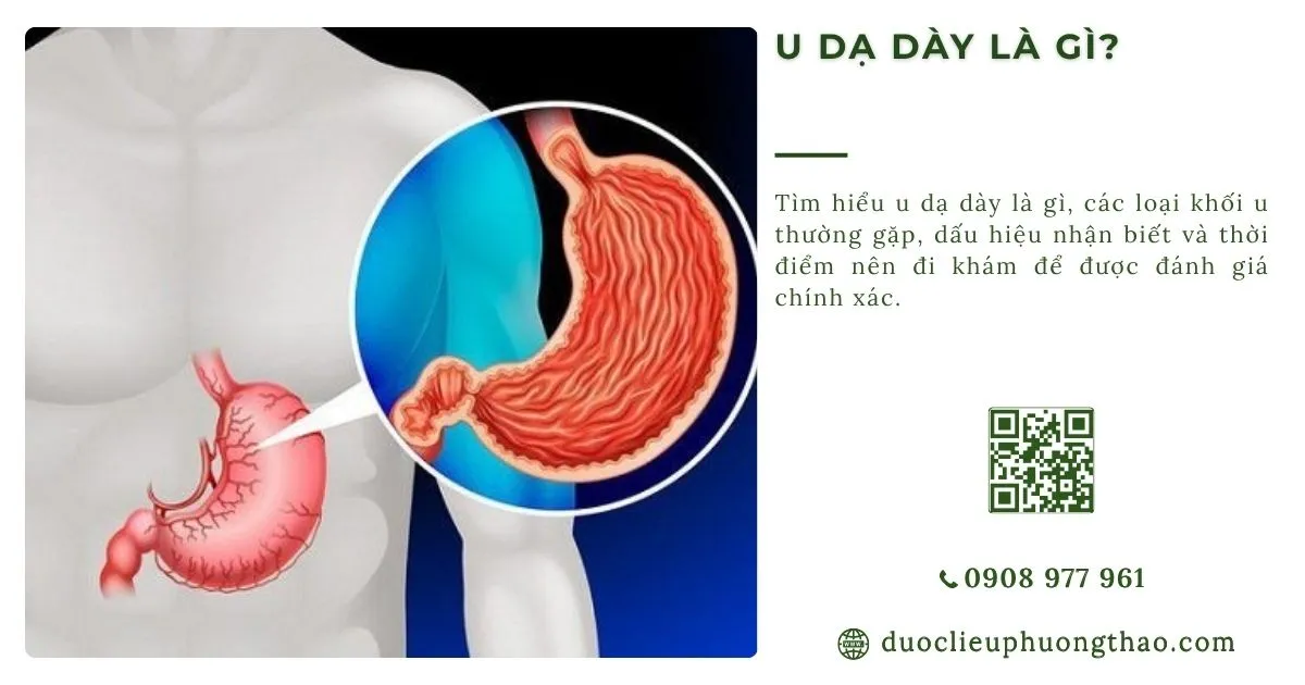 u dạ dày là gì