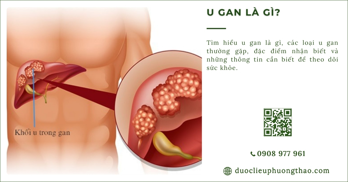 u gan là gì