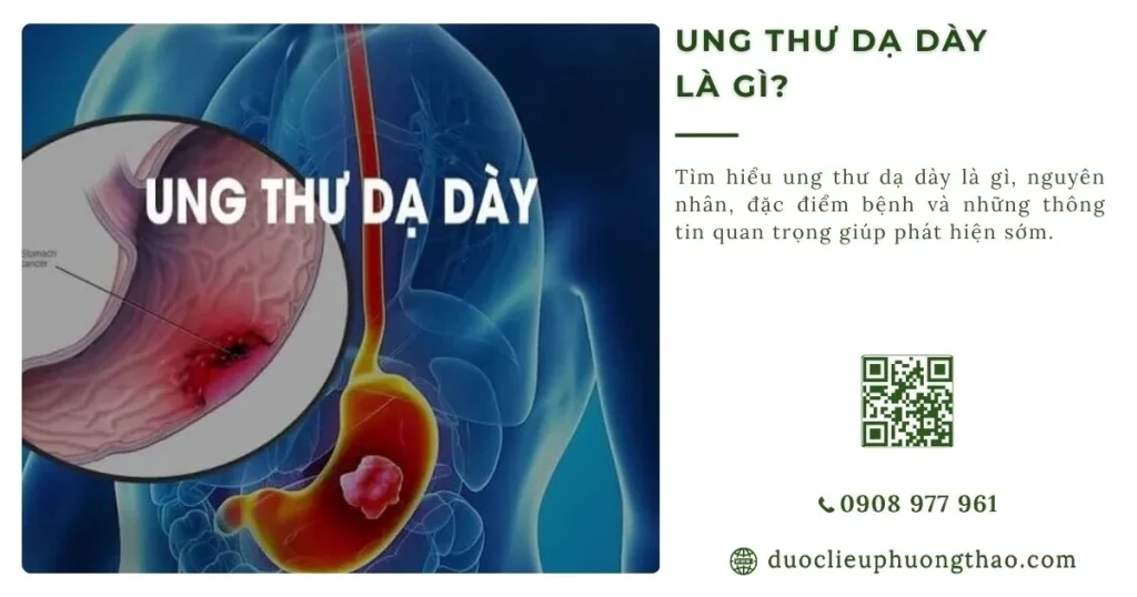 Ung thư dạ dày là gì? Nguyên nhân, dấu hiệu và hướng xử trí phù hợp