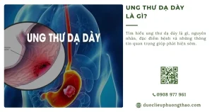 Ung thư dạ dày là gì? Nguyên nhân, dấu hiệu và hướng xử trí phù hợp