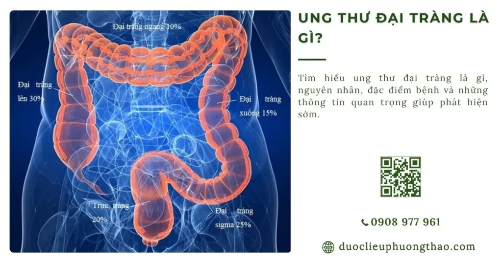 Ung thư đại tràng là gì? Nguyên nhân, triệu chứng và hướng xử lý cho người trung niên