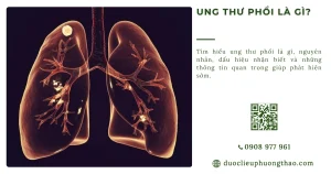 Ung thư phổi là gì? Giải thích dễ hiểu về nguyên nhân, dấu hiệu và cách xử trí