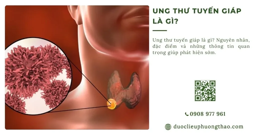 Ung thư tuyến giáp là gì? Nguyên nhân, triệu chứng và hướng điều trị phù hợp